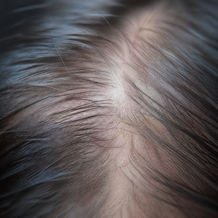 Your Hair Is Thinning At The Root